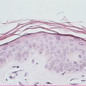 image02 Normal Corneum Layer